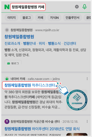 척추디스크센터 카페 가입안내1