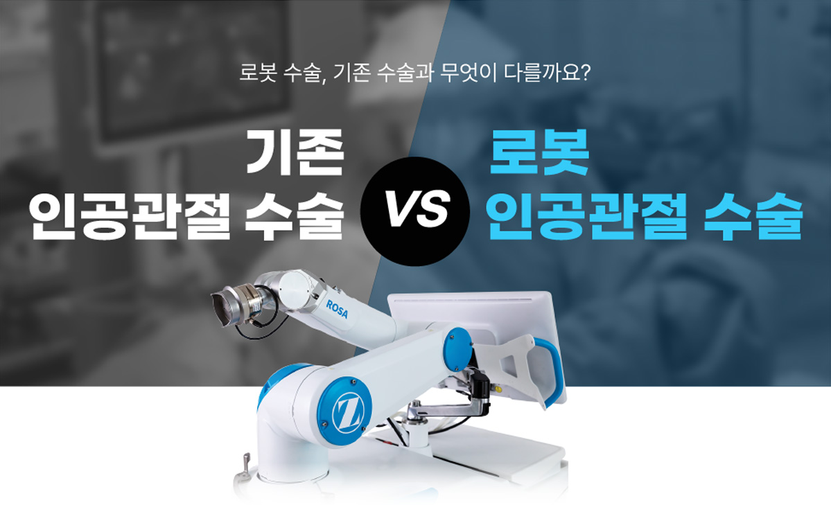 로봇 수술, 기존 수술과 무엇이 다를까요? 기존 인공관절수술 vs 로봇 인공관절 수술