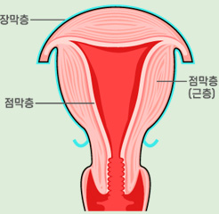 정상자궁 사진